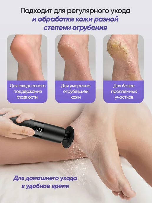 Puls Love Электрическая пилка для пяток и ног терка пемза, черный, фото 2
