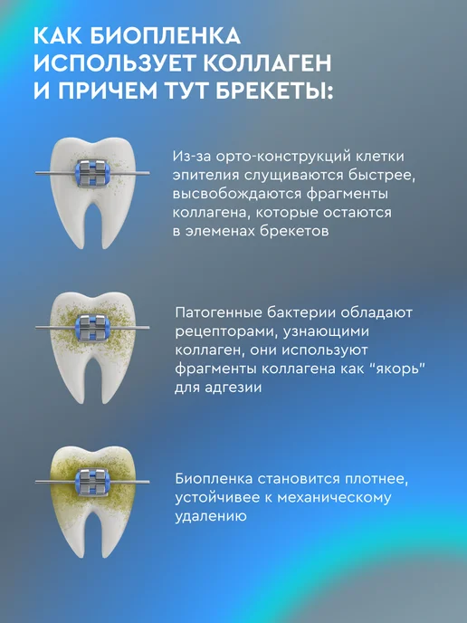 PRESIDENT Зубная паста для брекетов PROFI ORTHO-EXPERT (RDA 75) 90 г, 90 г, фото 7