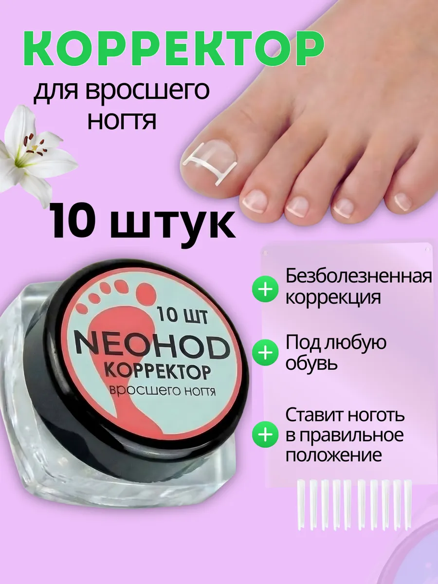 Корректор для вросших ногтей
