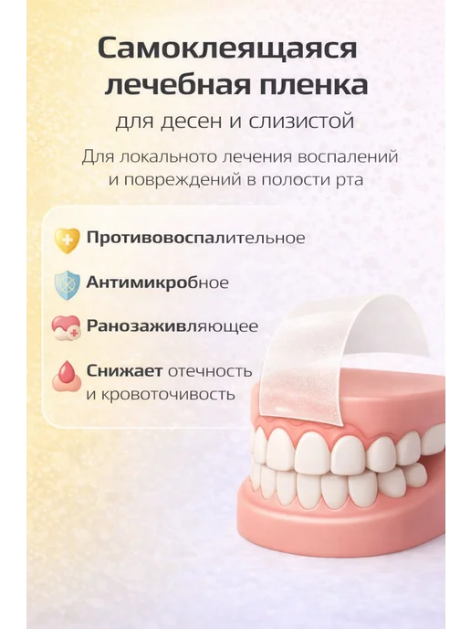 Nordost Диплен Дента Л пленка стоматологическая с линкомицином, желтый, фото 2