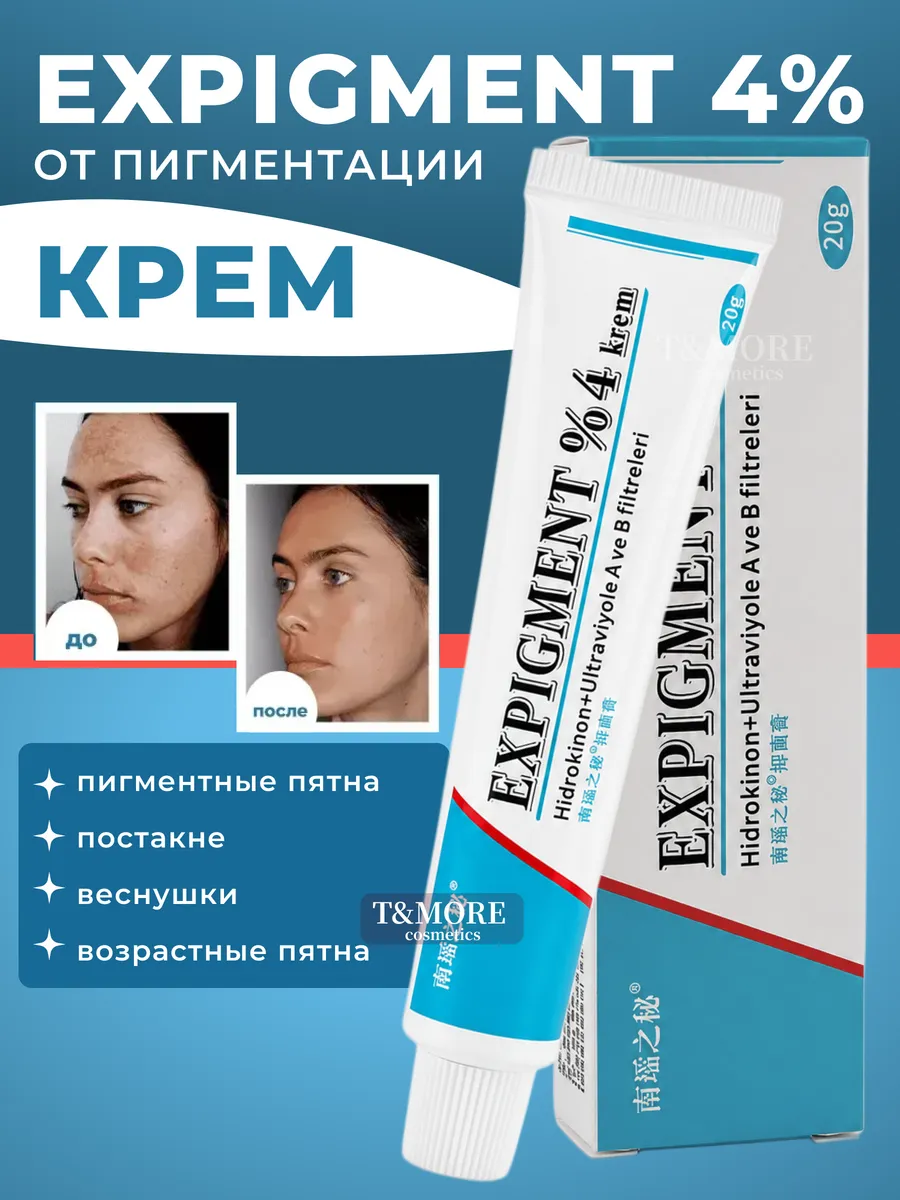 Крем для лица отбеливающий пигментацию експигмент