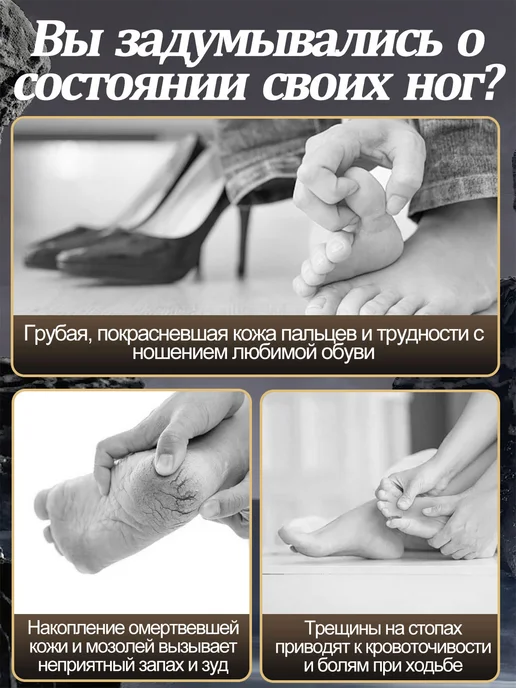 Электрическая пилка для пяток,аппарат для педикюра, белый, фото 2