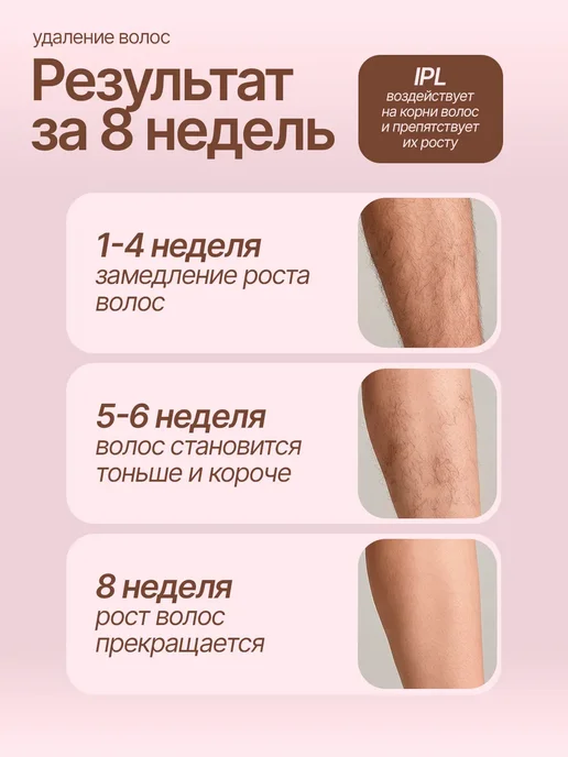 Фотоэпилятор лазерный профессиональный, белый, фото 2