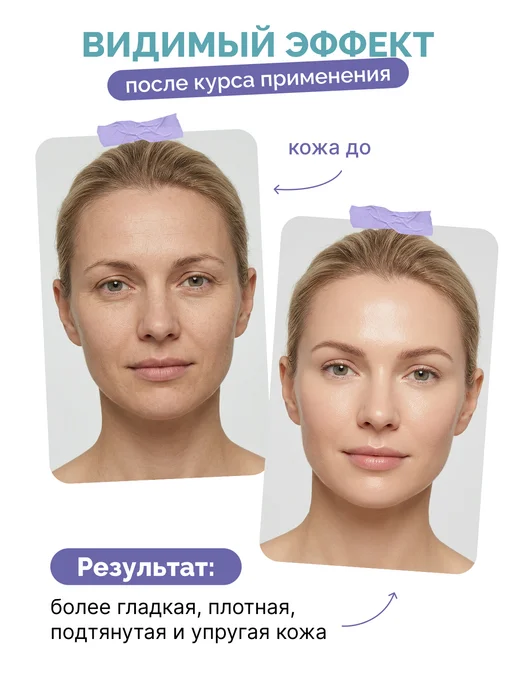 БьютиЦевтика Антивозрастной комплекс сывороток для лица для мезороллера, вариант, фото 4
