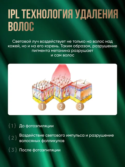 Фотоэпилятор лазерный для удаления волос, вариант, фото 5