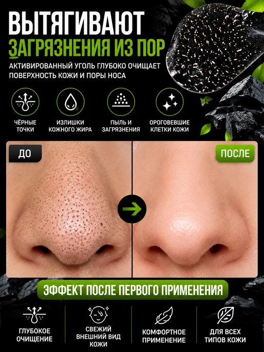 Полоски от черных точек на носу 20 шт, 20 шт, фото 2