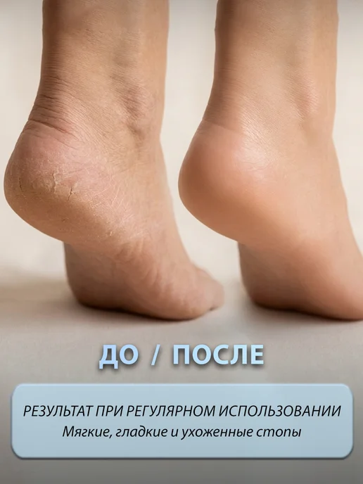 Пемза для пяток и ног, коричневый, фото 3