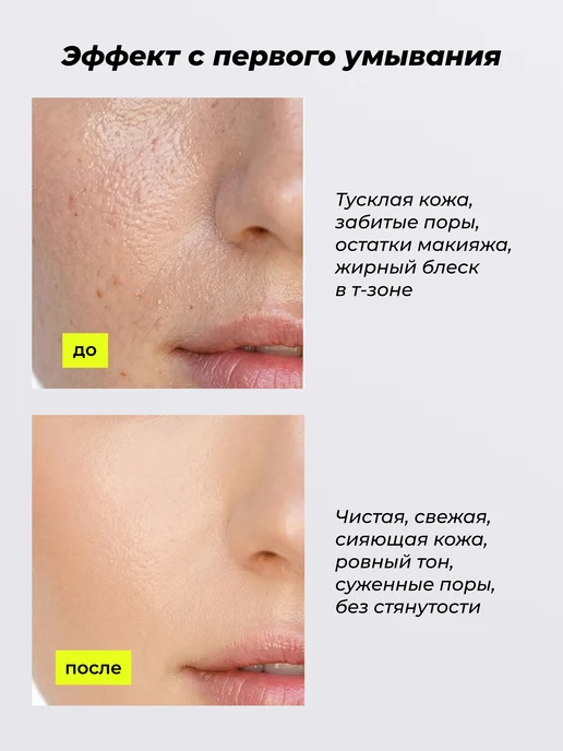 STARBERRY Пенка- мусс для умывания лица с ниацинамидом и витамином C, 150 мл, фото 3
